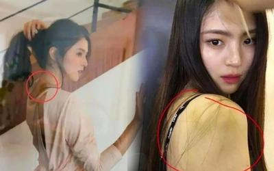 Căng: Rộ hình ảnh 'tiểu Song Hye Kyo' có nhiều vết bầm trên cơ thể, dân tình đặt ra nhiều nghi vấn